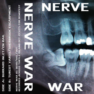 digital jcard mockup featuring an oral x-ray shwing fillings and an impacted wisdom tooth with NERVE WAR on the cover and spine, and the track titles.